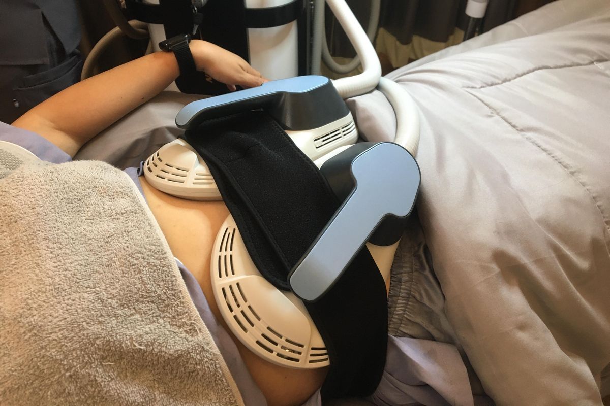 eva mulia clinic, cryo slimming treatment, cryo slimming, apa itu cryo slimming, treatment pembentukan tubuh, body shaping, efek samping cryo slimming, risiko cryo slimming, Efek Samping Cryo Slimming Pro untuk Kecilkan Lingkar Perut, Ini Kata Dokter, Apa itu cryo slimming pro?, Efek samping cryo slimming pro yang paling umum, Tidak mengganggu organ dalam, Siapa yang perlu hati-hati dengan cryo slimming pro?, Efektif membentuk lingkar tubuh, bukan turunkan berat badan