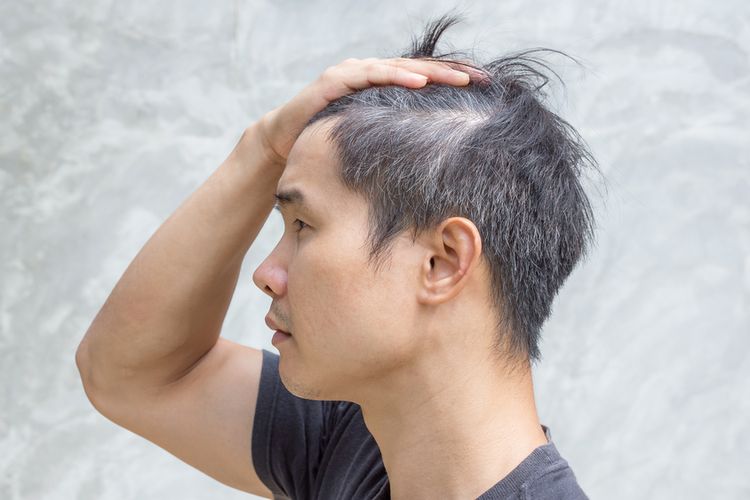Nadya Hutagalung, rambut beruban, uban, Nadya Hutagalung uban, rambut uban, penyebab rambut beruban, rambut beruban karena apa, apa penyebab muncul uban, Nadya Hutagalung Bangga Punya Uban, Apa Saja Faktor Penyebab Rambut Beruban?, 1. Penurunan produksi melanin, 2. Faktor usia dan genetik, 3. Paparan radikal bebas, 4. Kekurangan nutrisi, 5. Gangguan kesehatan tertentu, 6. Gaya hidup yang tidak sehat