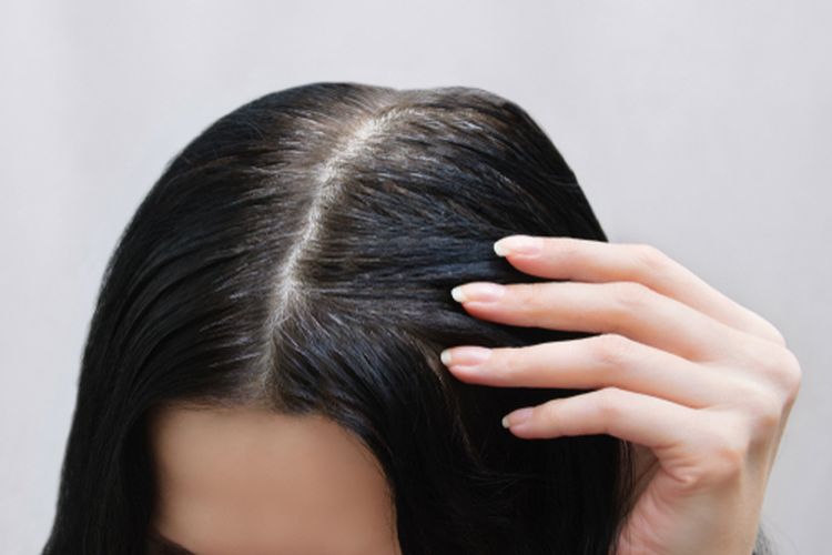 Nadya Hutagalung, rambut beruban, uban, Nadya Hutagalung uban, rambut uban, penyebab rambut beruban, rambut beruban karena apa, apa penyebab muncul uban, Nadya Hutagalung Bangga Punya Uban, Apa Saja Faktor Penyebab Rambut Beruban?, 1. Penurunan produksi melanin, 2. Faktor usia dan genetik, 3. Paparan radikal bebas, 4. Kekurangan nutrisi, 5. Gangguan kesehatan tertentu, 6. Gaya hidup yang tidak sehat
