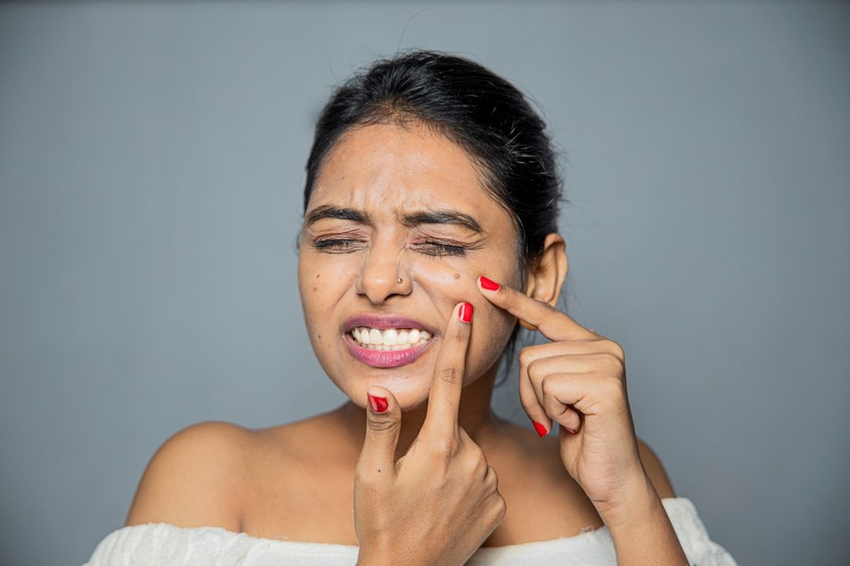kebiasaan yang dapat memperparah jerawat, kenapa jerawat selalu muncul, kesalahan memakai skincare, kenapa jerawat semakin banyak, hindari kebiasaan yang memperparah jerawat, 8 Kebiasaan yang Dapat Memperparah Jerawat, 1. Mencuci wajah terlalu sering atau terlalu kasar, 2. Menggunakan produk rambut terlalu dekat dengan garis rambut, 3. Menyentuh atau memencet jerawat, 4. Menggunakan produk perawatan kulit yang tidak sesuai, 5. Menggunakan terlalu banyak obat jerawat, 6. Mengonsumsi makanan tinggi gula dan karbohidrat olahan, 7. Menggunakan ponsel yang kotor, 8. menghentikan perawatan jerawat