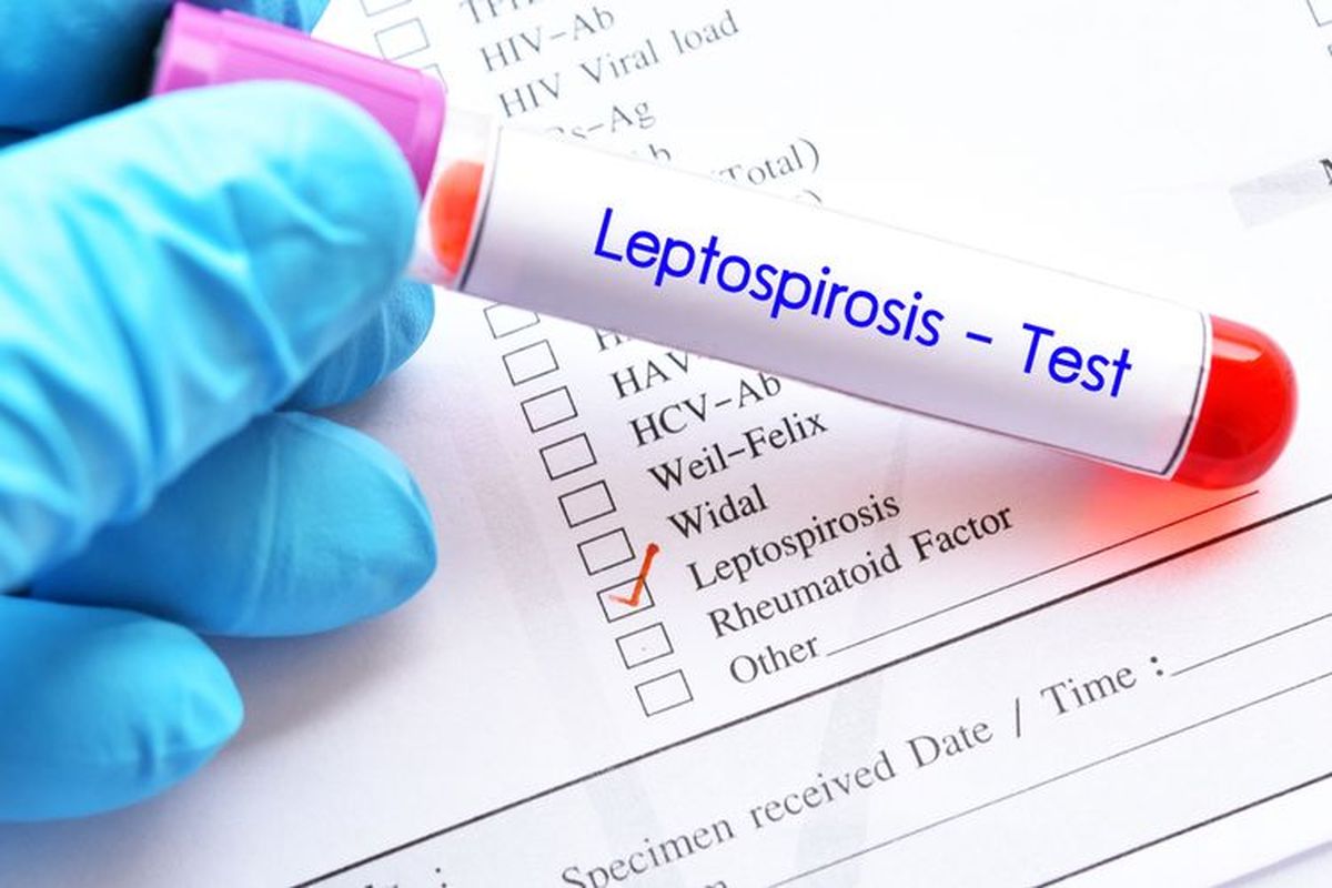 3 Warga Gunungkidul Meninggal akibat Leptospirosis, Kenali Gejala Demam yang Khas