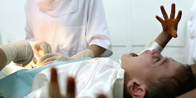 malapraktik sunat, malapraktik sunat di riau, bocah di pelalawan, korban sunat pelalawan, kronologi malapraktik sunat, bidan malapraktik sunat, Bocah Pelalawan Diduga Alami Malapraktik Sunat, Bagian Ujung Terpotong, Pengobatan korban ditanggung Pemkab Pelalawan, Selidiki legalitas izin praktik bidan, Bocah di Pelalawan jadi korban malapraktik sunat, Kronologi kejadian malapraktik sunat