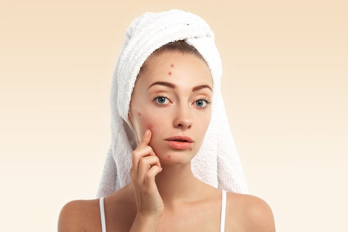 permasalahan kulit, Masalah Kulit di Setiap Fase Usia, permasalahan kulit remaja, permasalahan kulit sesuai usia, cara mengatasi permasalahan kulit, cara mengatasi permasalahan kulit wajah, mengatasi permasalahan kulit wajah sesuai usia, permasalahan kulit dewasa, masalah kulit di setiap fase usia, cara mengatasi masalah kulit, Ketahui Masalah Kulit di Setiap Fase Usia dan Cara Mengatasinya