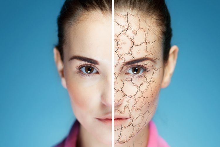 kulit kering, kulit dehidrasi, Kulit Kering Vs Kulit Dehidrasi, Apa Bedanya? Ini Penjelasan Dokter