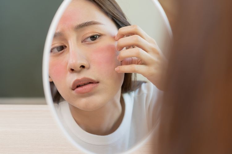 skincare, moisturizer, face wash, dokter kulit, ganti skincare, efek ganti skincare, efek gonta ganti skincare, Gonta-ganti Skincare Bisa Picu Jerawat dan Beruntusan, Ini Kata Dokter, Dampak gonta-ganti skincare, bisa menyebabkan jerawat, Risiko efek samping bisa muncul dalam berbagai bentuk, Reaksi kulit setiap orang berbeda, Bijak dalam memakai sunscreen