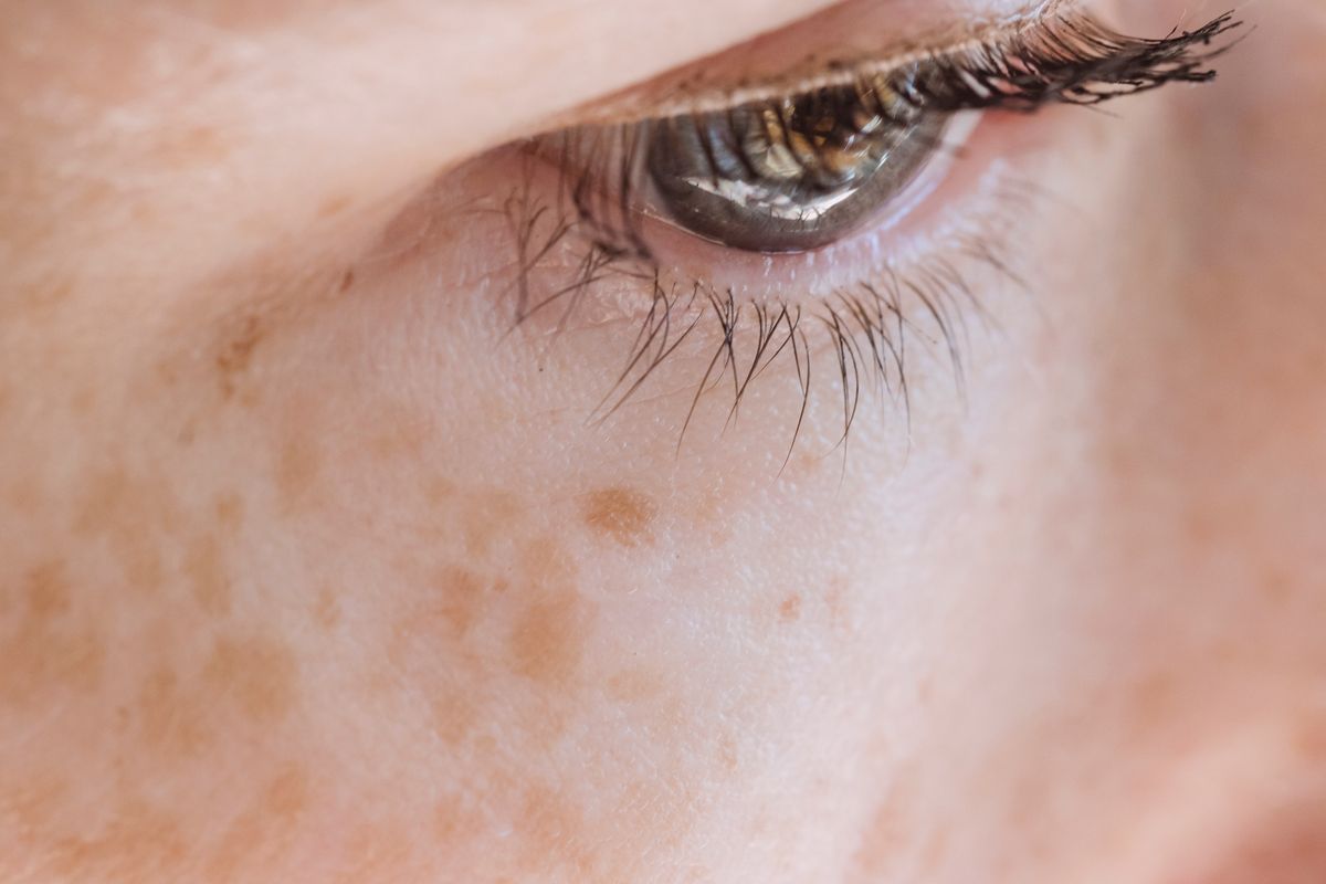 tips kecantikan, flek hitam di wajah, skincare untuk flek hitam, hiperpigmentasi cara mengatasi, kandungan skincare yang baik untuk flek hitam, Kandungan Skincare Penghilang Flek Hitam, Salah Satunya Retinol, 1. Gunakan sunscreen, 2. Produk dengan antioksidan yang kaya, 3. Retinol, 4. Eksfoliasi dengan produk yang lembut