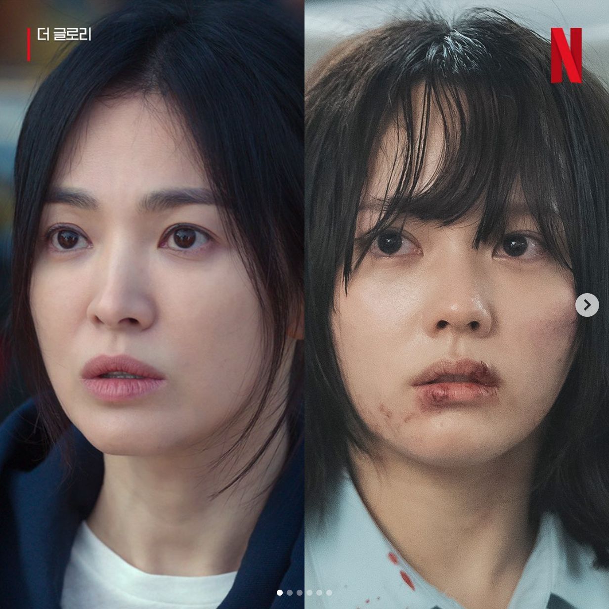 Array,Profil 6 Pemain Muda The Glory, Pemeran Song Hye Kyo Remaja Tuai Pujian