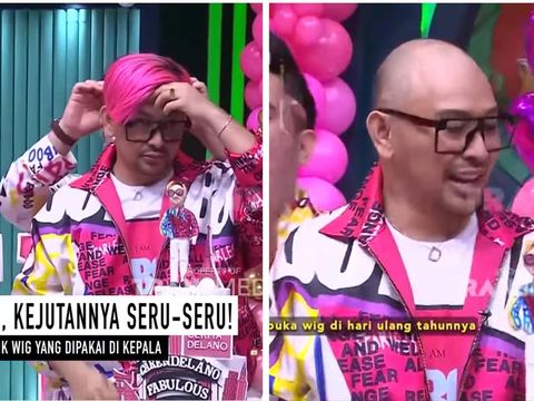 5 Fakta Caren Delano yang Disebut Mirip Ivan Gunawan Setelah Operasi Plastik, Berikut sederet fakta tentang Caren Delano yang membuat heboh warganet:, 3. Tidak Operasi Bibir, 4. Caren Delano Lepas Wig, 5. Caren Delano Disebut Mirip dengan Ivan Gunawan
