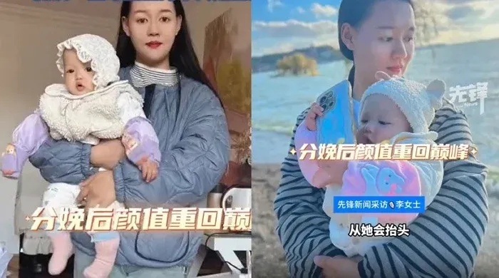 Array,Viral Transformasi Wanita saat Hamil, Wajah Menggelap-Berkerut Bak Beda Orang