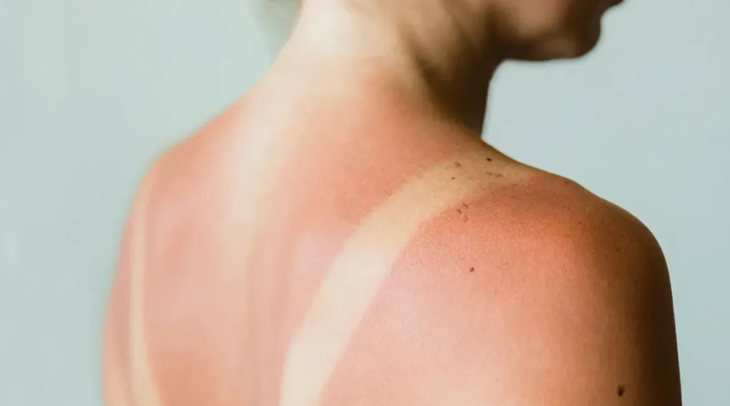 Pilih Jenis Sunscreen yang Kamu Suka, Gunakan Minimal SPF 30, Reapply Setiap 2-3 Jam Sekali, Hindari SPF di atas 50, Gunakan Sunscreen Setelah Pelembap, Gunakan Sunscreen dalam Takaran yang Cukup, Melindungi dari Radiasi UVA dan UVB, Mencegah Sunburn, Mengurangi Risiko Kanker Kulit, Mencegah Penuaan Dini, Menjaga Kulit Tetap Sehat