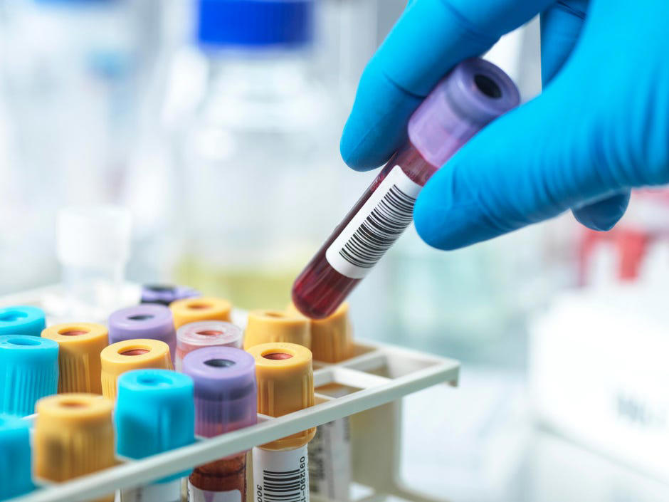 What is cortisol?, Should you get a cortisol test? , What is a cortisol blood test? , My cortisol blood test results , What are normal cortisol levels? , How high can cortisol levels go? , Can anxiety affect cortisol? , What other cortisol tests are there?, What happens if a cortisol blood test is abnormal?, What can cause abnormal cortisol levels? , How can high cortisol affect health? , Should people be concerned about their cortisol levels?, How can you naturally reduce cortisol?, The bottom line 