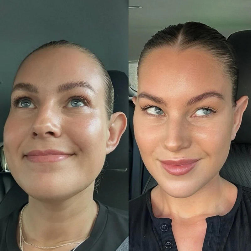 The decision to undergo a facelift., The procedure., The recovery., The commentary around her decision.
