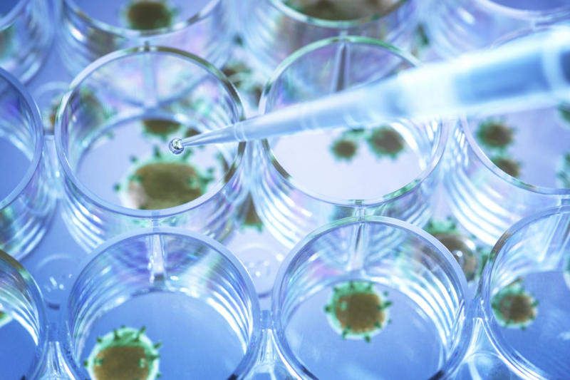 How was the study carried out? New study, Seven years of protection, Links between virus and brain decline, Shingles, Reactivation, Painful and dangerous, Possible links, Older studies, Wales data, Natural experiment, Comparing similar groups, Discarding other factors