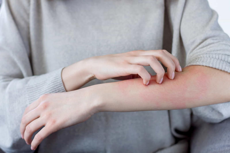 Inflammation, The body's defense, Symptoms of inflammation, Inflammation response, Effects of inflammation, Depression and bipolar disorder, Anxiety and trauma, The gut and the brain, Inflammation causes, Mind-body medicine