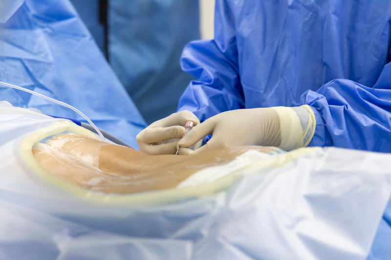 Factors that make a medical procedure expensive: complexity, Factors that make a medical procedure expensive: equipment, Factors that make a medical procedure expensive: medical staff, Heart transplant, Liver transplant, Bone marrow transplant, Double lung transplant, Intestinal or small bowel transplant, Pancreas transplant, Kidney transplant, Exploratory chest surgery, Esophagectomy, Tracheostomy, Transcatheter aortic valve replacement, Carotid artery stent, Lumbar spine surgery