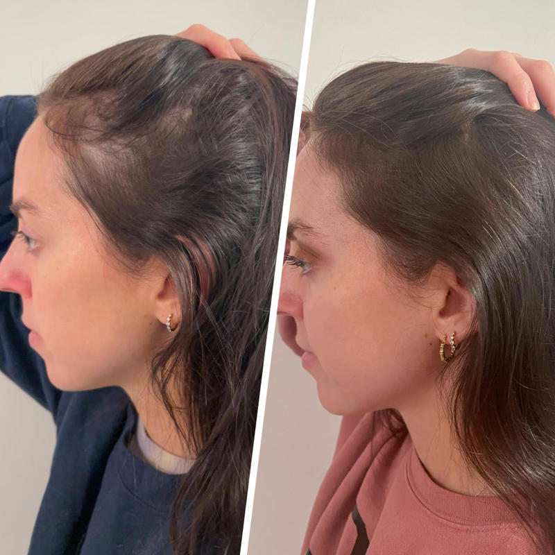 The best hair growth products, according to experts and tested by editors, The best red-light therapy devices, according to experts and tested by editors, The best scalp care products, according to experts and tested by editors, How we chose, Meet the experts