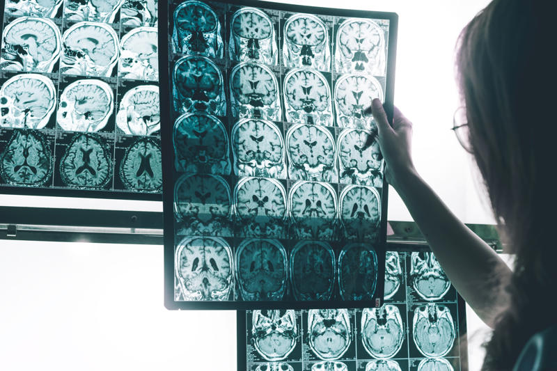 Alzheimer's disease, Worldwide incidences of the disease, Early diagnosis, Death rate, Initial symptoms, Constant care, Middle-stage symptoms, Losing awareness, Duration of illness, Difficulty in diagnosis, Treatment, Alternative treatments, Cognitive and behavioral therapy
