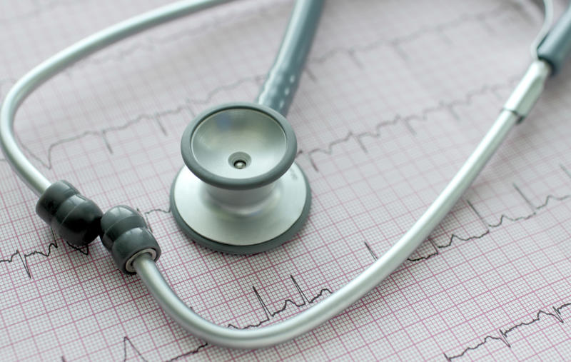 Cardiac arrest, Heart attack, Arrhythmias, Congestive heart failure, Respiratory arrest, Type 1 diabetes, Carbon monoxide poisoning, Medications, Brain trauma, Epilepsy, Obstructive sleep apnea