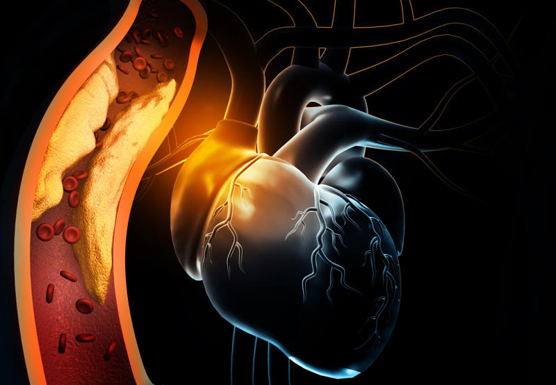 Cardiac arrest, Heart attack, Arrhythmias, Congestive heart failure, Respiratory arrest, Type 1 diabetes, Carbon monoxide poisoning, Medications, Brain trauma, Epilepsy, Obstructive sleep apnea
