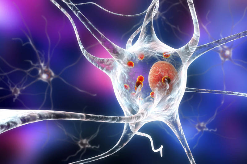 What is Parkinson's disease? What is Parkinson's disease?, What is dopamine?, Who's affected?, When do symptoms develop?, What are the symptoms?, Psychological symptoms, Living with Parkinson's disease, Physiotherapy, Mobility aids and assistance, Keep a Parkinson's diary, Specialist care, Relationships and support, Daily support, Get active, Help them feel normalcy