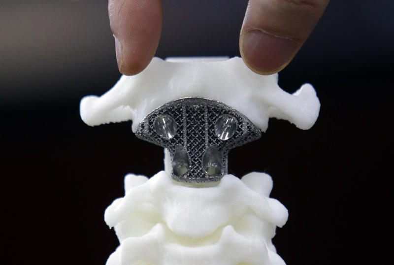 A spine axis Unborn baby, Yourself, A spine axis, Prosthetic hand, Prosthetic forearm, A toucan beak, Ice cream, A chocolate beer bottle, A bicycle, A motorcycle, Aircraft seats, Plastic working handguns, Adidas shoes, Office space