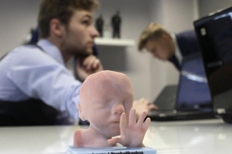 Unborn baby Unborn baby, Yourself, A spine axis, Prosthetic hand, Prosthetic forearm, A toucan beak, Ice cream, A chocolate beer bottle, A bicycle, A motorcycle, Aircraft seats, Plastic working handguns, Adidas shoes, Office space