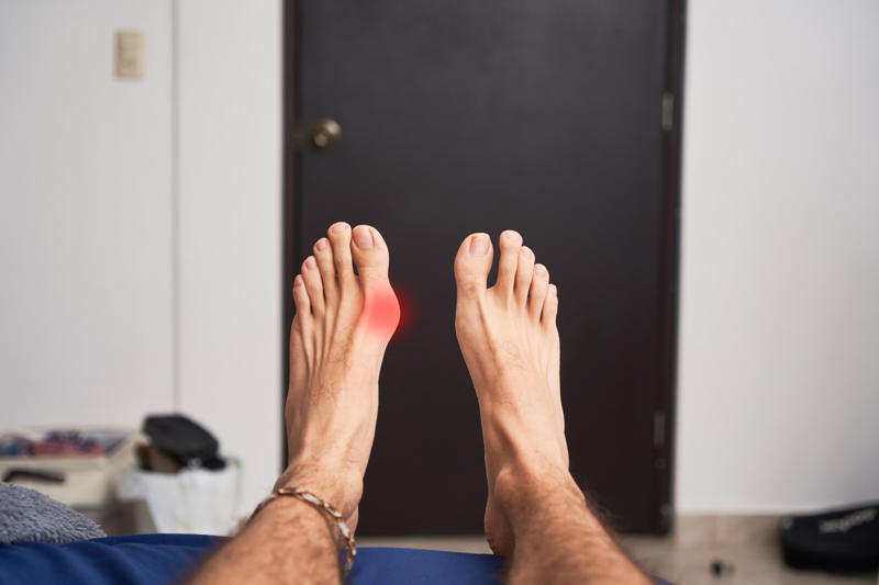 Foot shape What's a bunion?, Slow development, Who is affected?, An acquired deformity, Foot shape, Egyptian foot shape, Early signs, Bunion pain, Nerves and crowding, Treatment options, At-home relief, Pharmacy products