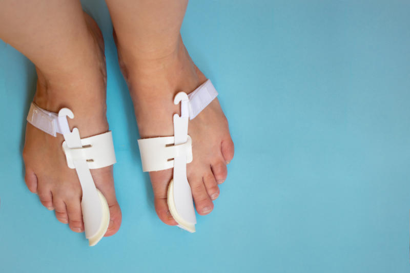 Pharmacy products What's a bunion?, Slow development, Who is affected?, An acquired deformity, Foot shape, Egyptian foot shape, Early signs, Bunion pain, Nerves and crowding, Treatment options, At-home relief, Pharmacy products