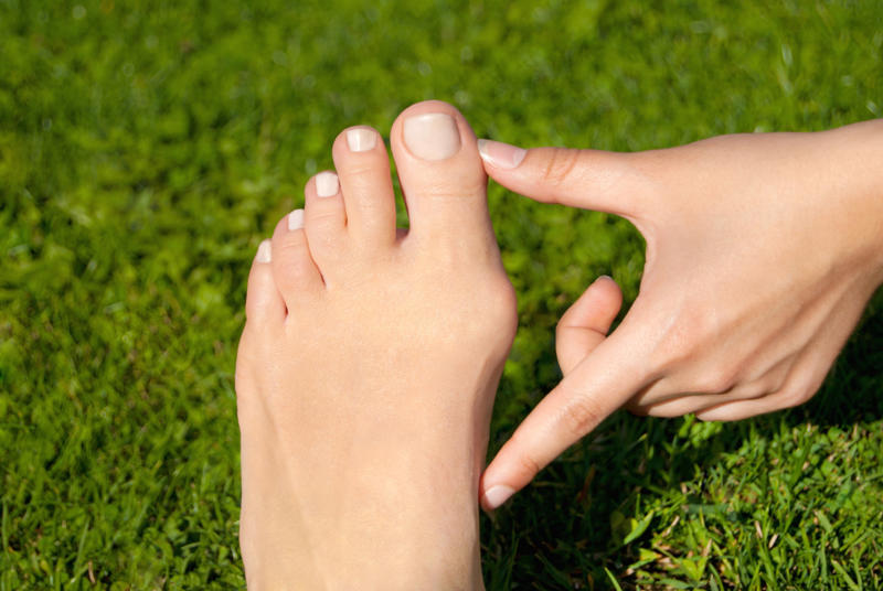 Early signs What's a bunion?, Slow development, Who is affected?, An acquired deformity, Foot shape, Egyptian foot shape, Early signs, Bunion pain, Nerves and crowding, Treatment options, At-home relief, Pharmacy products