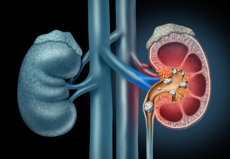 Promoting a healthy body What are the kidneys?, How they work, Promoting a healthy body, Bloodwork, Where are the kidneys?, How kidneys are nourished, How to maintain healthy kidneys, Whole grain high-fiber foods, Limit alcohol intake, Get enough sleep, Underlying health issues, Beware of blood in urine, Kidney disease, Kidney transplant statistics, Simple blood test