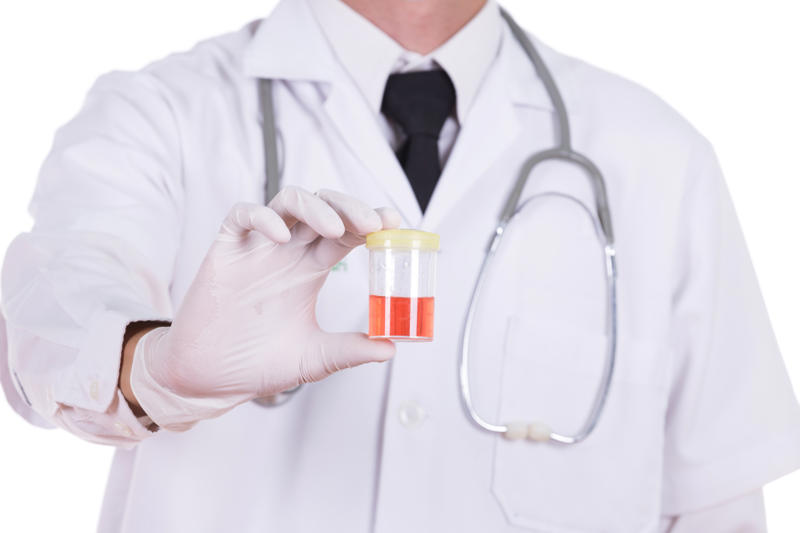 Beware of blood in urine What are the kidneys?, How they work, Promoting a healthy body, Bloodwork, Where are the kidneys?, How kidneys are nourished, How to maintain healthy kidneys, Whole grain high-fiber foods, Limit alcohol intake, Get enough sleep, Underlying health issues, Beware of blood in urine, Kidney disease, Kidney transplant statistics, Simple blood test