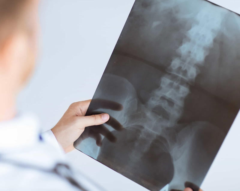 Spine health, Proper nutrition, What to eat for good spine health, Plant-based proteins, Leafy green vegetables, Omega-3 fatty acids, Herbs and spices, Rosemary, Red grapes, Reduce swelling, boost nerve function, Go bananas!, Are you nuts?