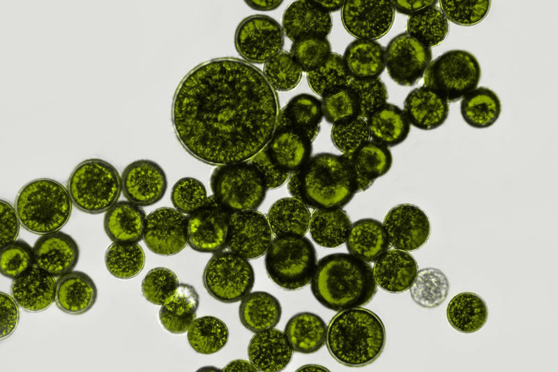 Microbial changes Muscle atrophy, Fluid redistribution, Peripheral edema, Cardiovascular deconditioning, Radiation exposure, Immune system reactivation, Vestibular system adaptations, Dental health issues, Microbial changes, Decompression sickness, Weight loss, Hearing loss, Decreased lung function