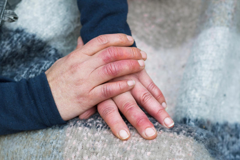 Peripheral edema Muscle atrophy, Fluid redistribution, Peripheral edema, Cardiovascular deconditioning, Radiation exposure, Immune system reactivation, Vestibular system adaptations, Dental health issues, Microbial changes, Decompression sickness, Weight loss, Hearing loss, Decreased lung function