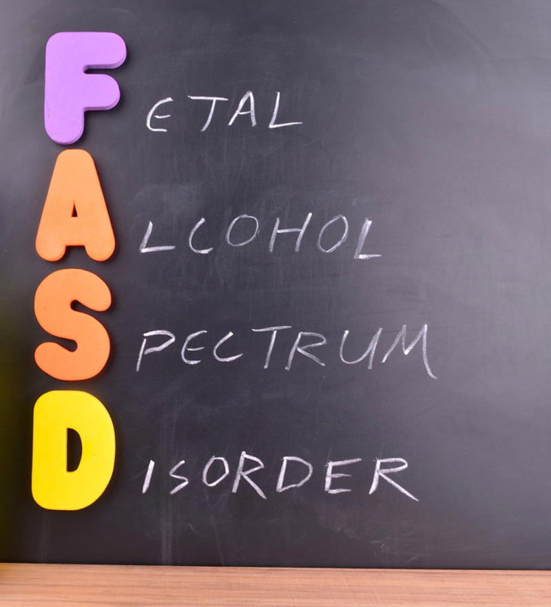 FASDs Defining developmental disabilities, Difficulties, Cerebral palsy, Down syndrome, Fragile X syndrome, Combination of factors, Other relevant factors, Diagnosing developmental disabilities, Milestone Tracker app, Speak up, AAP recommendation, At the appointment