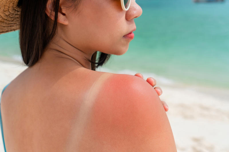 Avoid tanning The Human Cell Atlas project, Seborrheic keratosis, Age spots, Cherry angioma, Solar elastosis, Spider veins, Contact dermatitis, Contact dermatitis and aging, Sagging skin, Skin cancer, Celebrities who embrace their aging skin: Meryl Streep, Susan Sarandon, Avoid tanning, Avoid smoking, Changing position often, Manage stress