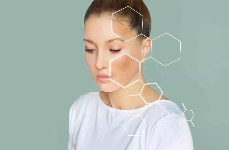 Skin symptoms Why is it so useful?, Introducing chimerism, Rare phenomenon, Different types of chimerism, Microchimerism, Artificial chimerism, Twin chimerism, Skin symptoms, Non-visible symptoms, Left to chance, Failed paternity test, Failed maternity test, Taylor Muhl, Bone marrow transplants, Pregnancy