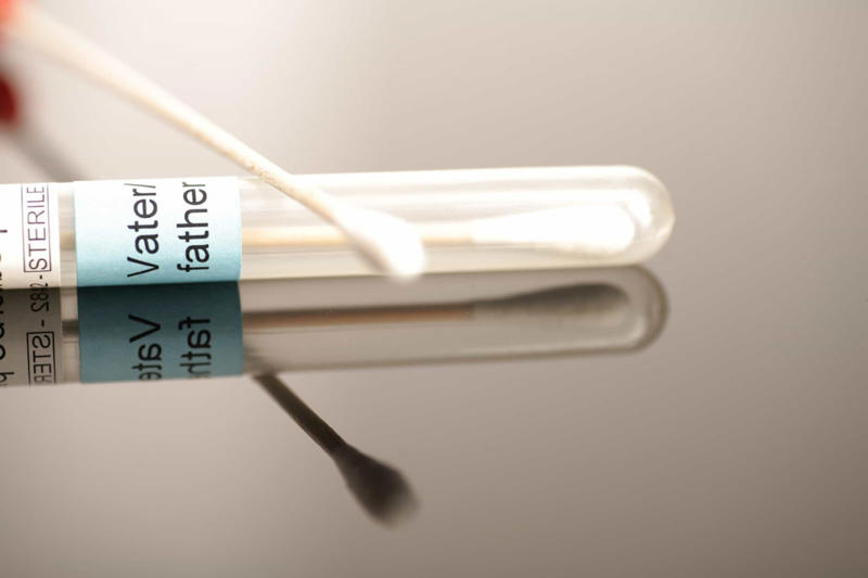 Failed paternity test Why is it so useful?, Introducing chimerism, Rare phenomenon, Different types of chimerism, Microchimerism, Artificial chimerism, Twin chimerism, Skin symptoms, Non-visible symptoms, Left to chance, Failed paternity test, Failed maternity test, Taylor Muhl, Bone marrow transplants, Pregnancy