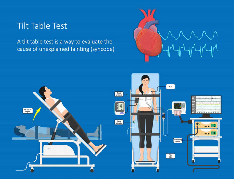 Dysautonomia, Automatic nervous system, Primary dysautonomia, Associated illnesses, Who gets it?, How serious is it?, The symptoms, Triggers, Primary conditions, Postural orthostatic tachycardia syndrome (POTS), Familial dysautonomia (FD), Pure autonomic failure, Tilt-table testing, Other tests, How is it treated?