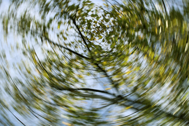 Dangerous disease, What is a stroke?, Quick response, Diagnosis, Emergency, Other signs, Body numbness, Dizziness, Types of strokes, Ischemic stroke, Ischemic stroke subtype, Hemorrhagic stroke causes, Hemorrhagic stroke risk factor, Most affected groups, Medical exam, Further exams, Echocardiogram, Ischemic stroke treatment, Hemorrhagic stroke treatment, Paralysis or loss of movement, Deep vein thrombosis (DVT)