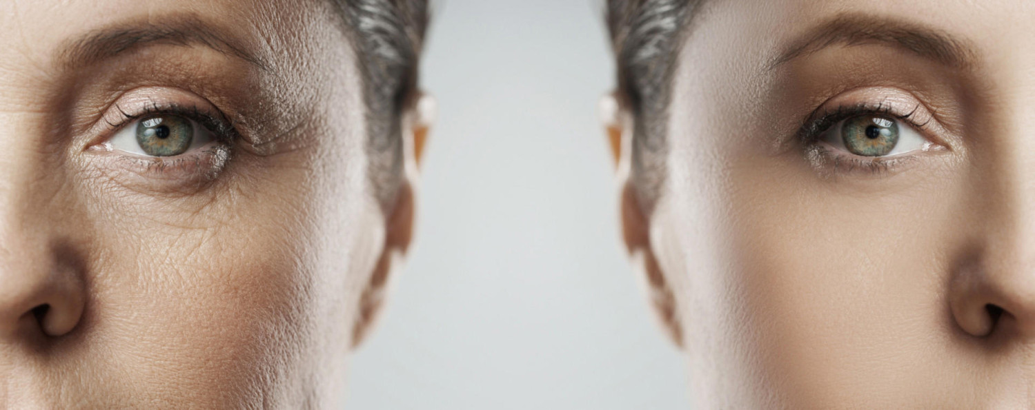 The middle layer: dermis Ingredient-led beauty, Ingredient claims, Ingredient claims, Ingredient claims, Search surge, Millennials and Gen Z, Fad, or foresight?, Skin layers, Skin barrier, The middle layer: dermis, Biomolecules, Formulations, Dermis layer absorption, Peptides, Investigation