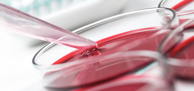 Red dye 40 and cancer What is red dye 40?, Foods that contain red dye 40, When was it introduced?, How to identify red dye 40?, Where else is red dye 40 found?, Is red dye 40 safe?, Growing concerns, Red dye 40 and ADHD, Red dye 40 and gut health, Red dye 40 and cancer, Red dye 40 and neurological health, Tips for avoiding red dye 40, California banning red dye 3, Red dye 40 in Europe, Further research