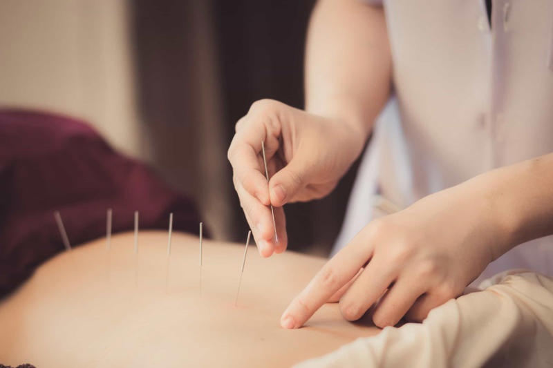 Almost anyone can benefit from acupuncture The origin of the word, Qi plays a vital role in acupuncture, There are over 300 acupuncture points on the body, Acupuncture has very few side effects, Almost anyone can benefit from acupuncture, Even animals can get acupuncture, It takes a lot of training to become a licensed acupuncturist, Acupuncturists look at your tongue and feel your pulse, Acupuncture is preventative medicine, Today's acupuncture needles, Acupuncture is often covered by health insurance, When in doubt, ask