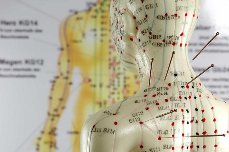 There are over 300 acupuncture points on the body The origin of the word, Qi plays a vital role in acupuncture, There are over 300 acupuncture points on the body, Acupuncture has very few side effects, Almost anyone can benefit from acupuncture, Even animals can get acupuncture, It takes a lot of training to become a licensed acupuncturist, Acupuncturists look at your tongue and feel your pulse, Acupuncture is preventative medicine, Today's acupuncture needles, Acupuncture is often covered by health insurance, When in doubt, ask