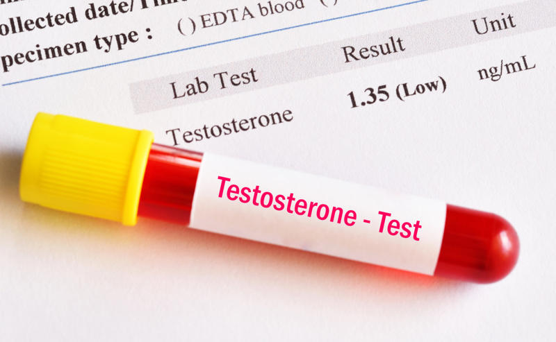 Condition, Testosterone levels, What causes low testosterone levels?, Testosterone levels decrease with age, Low libido, Fewer erections, Decreased ejaculate volume, Development of breasts, Increase in body fat, Mood swings, Sleep problems, Night sweats and/or hot flashes, It can affect children, Testosterone also affects women, How high testosterone levels affect women, How low testosterone levels affect women, Treatment