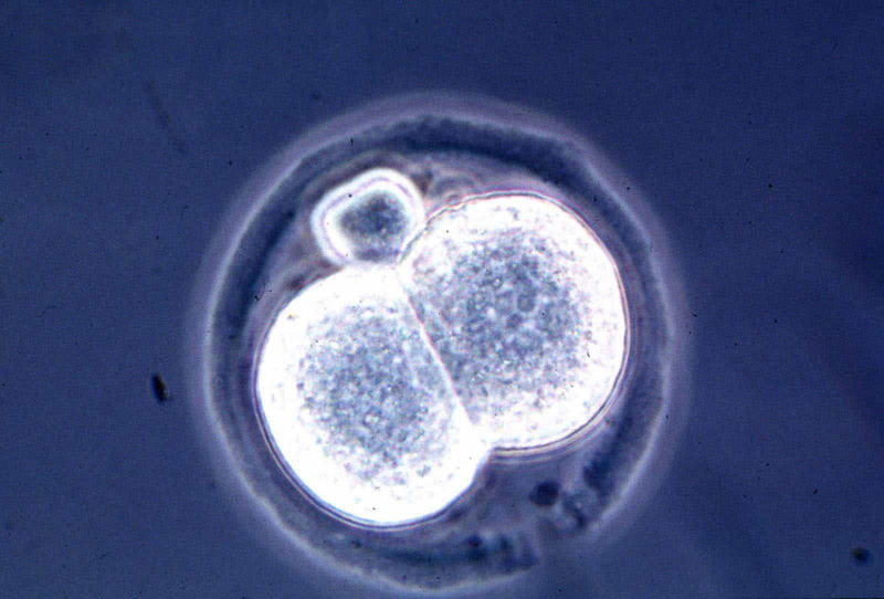 Irreversible cell differentiation Irreversible cell differentiation, Spontaneous generation, Phrenology, Geocentric theory, Phlogiston, The Piltdown Man, The age of the earth, The blank slate theory, Einstein's Universe, Planet Vulcan, The growing earth theory, The creation of killer bees, The fen-phen diet, The MTBE problem, The Milky Way as the entire universe