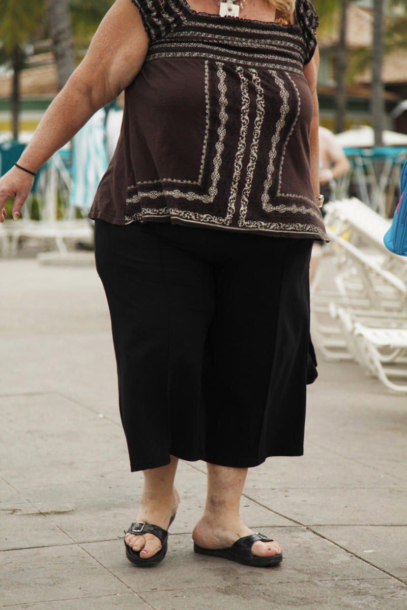 10. The Bahamas Why keep track of body weight?, What causes weight gain?, Health conditions linked to obesity, Leading cause of preventable death, Epidemic, BMI as a measurement, Type 2 diabetes, 10. The Bahamas, 9. French Polynesia, 8. Samoa, 7. Tuvalu, 5. The Cook Islands, 4. Tokelau, 3. Nauru, 2. Tonga, 1. American Samoa