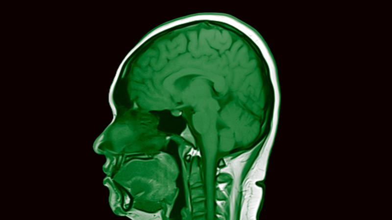 Beyond ordinary memory, When perception plays tricks, More questions than answers, Dopamine’s role, How age shapes déjà vu experiences, The brain’s role in déjà vu, When the brain overreacts, Completing the déjà vu cycle, The truth about déjà vu, Jamais vu explained simply, The strange effect of repeating words, Why jamais vu feels so weird