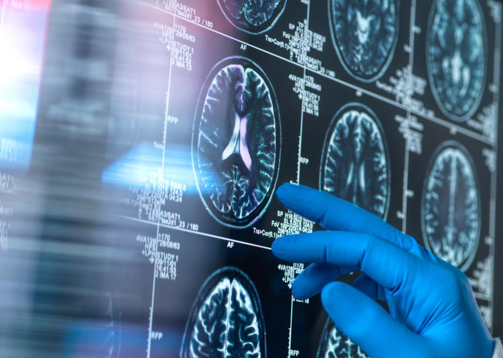 What did the researchers do?, What did they find?, What is the tip-of-the-tongue phenomenon?, How can you keep your brain active?