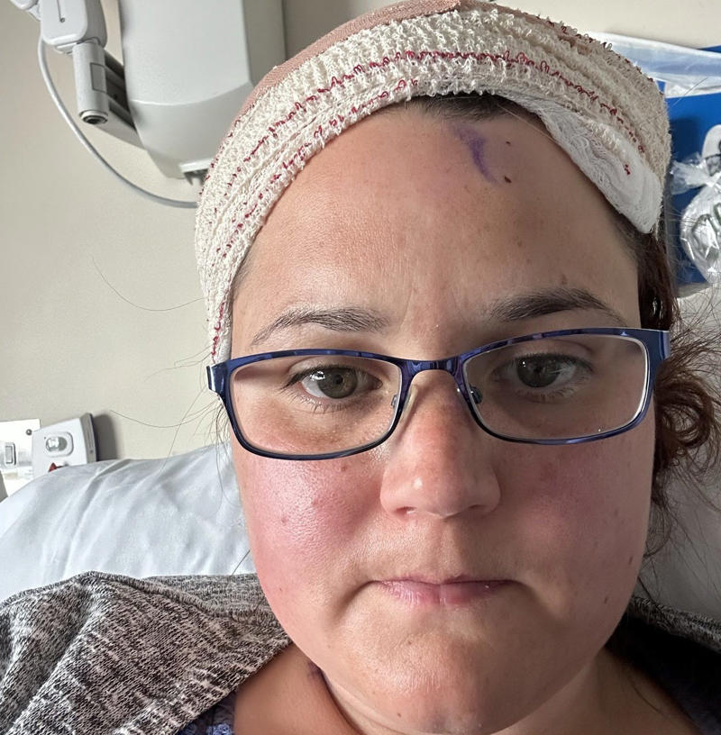 ‘I thought my symptoms were baby brain – until the doctors found a brain tumour’